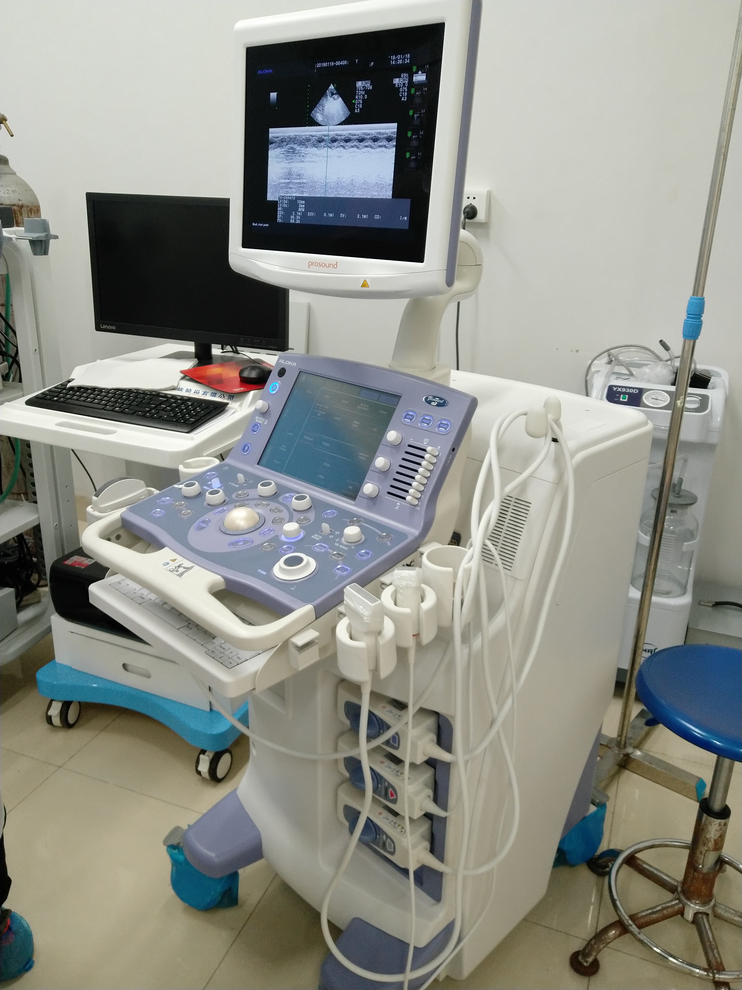 彩色超声诊断仪
